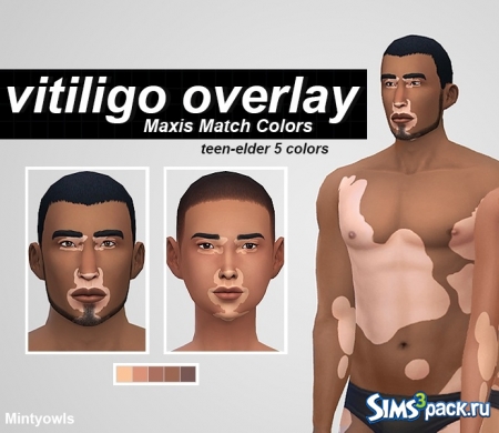 Скинтон "Vitiligo" от mintyowls